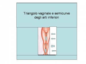 (Foto dal libro: Chirurgia estetica mini invasiva con fili di sostegno - P.A. Bacci - Minelli Editore 2006)